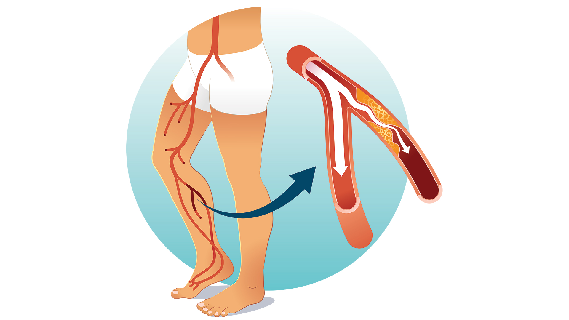 μια-νέα-προσέγγιση-για-την-περιφερική-563831404