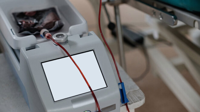 λάθος-μετάγγιση-αίματος-τι-ελέγχει-το-563803516