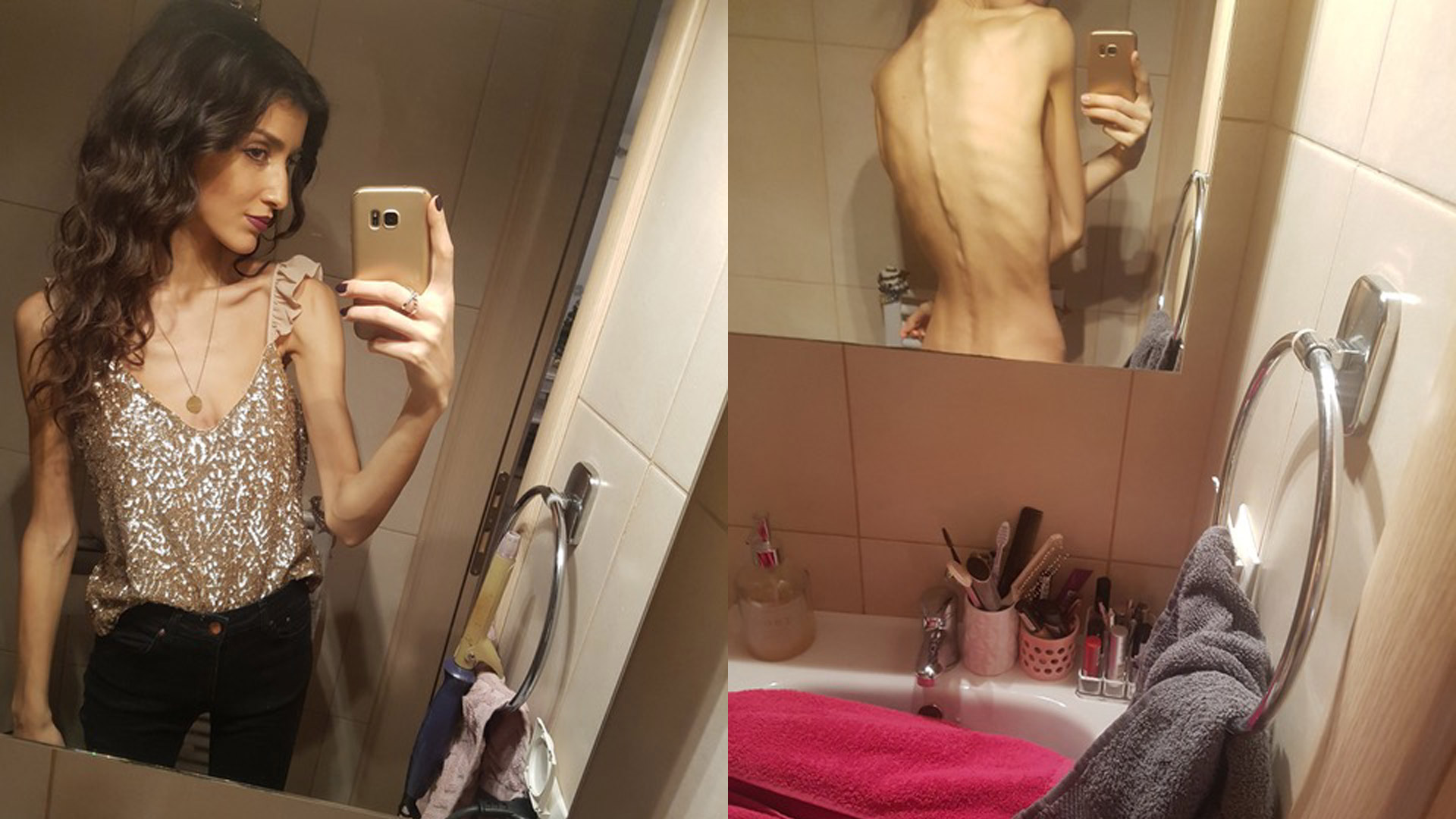 «Η κόρη μου δεν τρώει. Δεν με αφήνει καν να δω τη ζυγαριά»-3