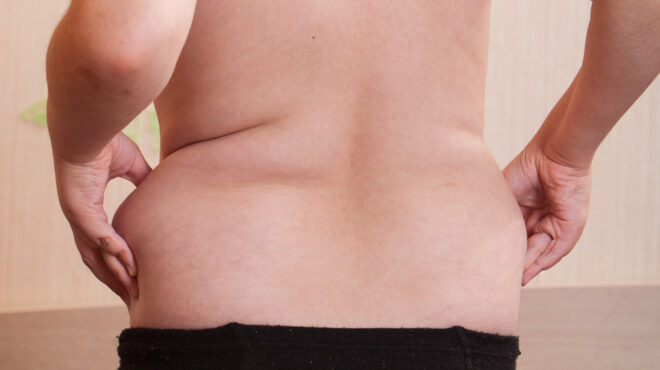πιο-πολλά-παχύσαρκα-από-λιποβαρή-παιδ-563812084