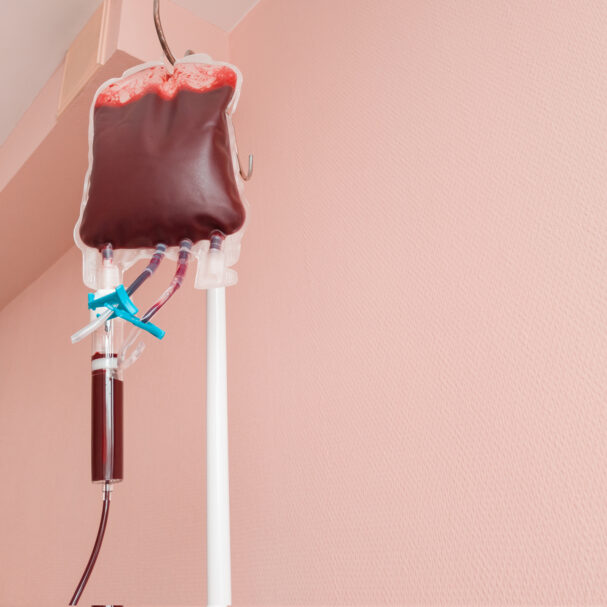 το-πόρισμα-για-τη-λάθος-μετάγγιση-563807638