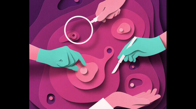 καλά-νέα-για-τον-καρκίνο-του-προστάτη-563857750