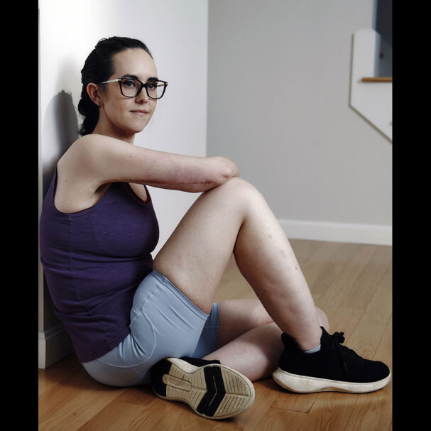 τα-επιπλέον-κιλά-έφυγαν-αλλά-τι-γίνετα-563845342