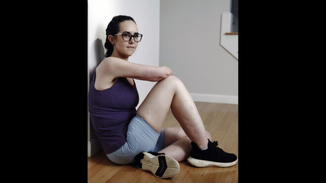 τα-επιπλέον-κιλά-έφυγαν-αλλά-τι-γίνετα-563845342