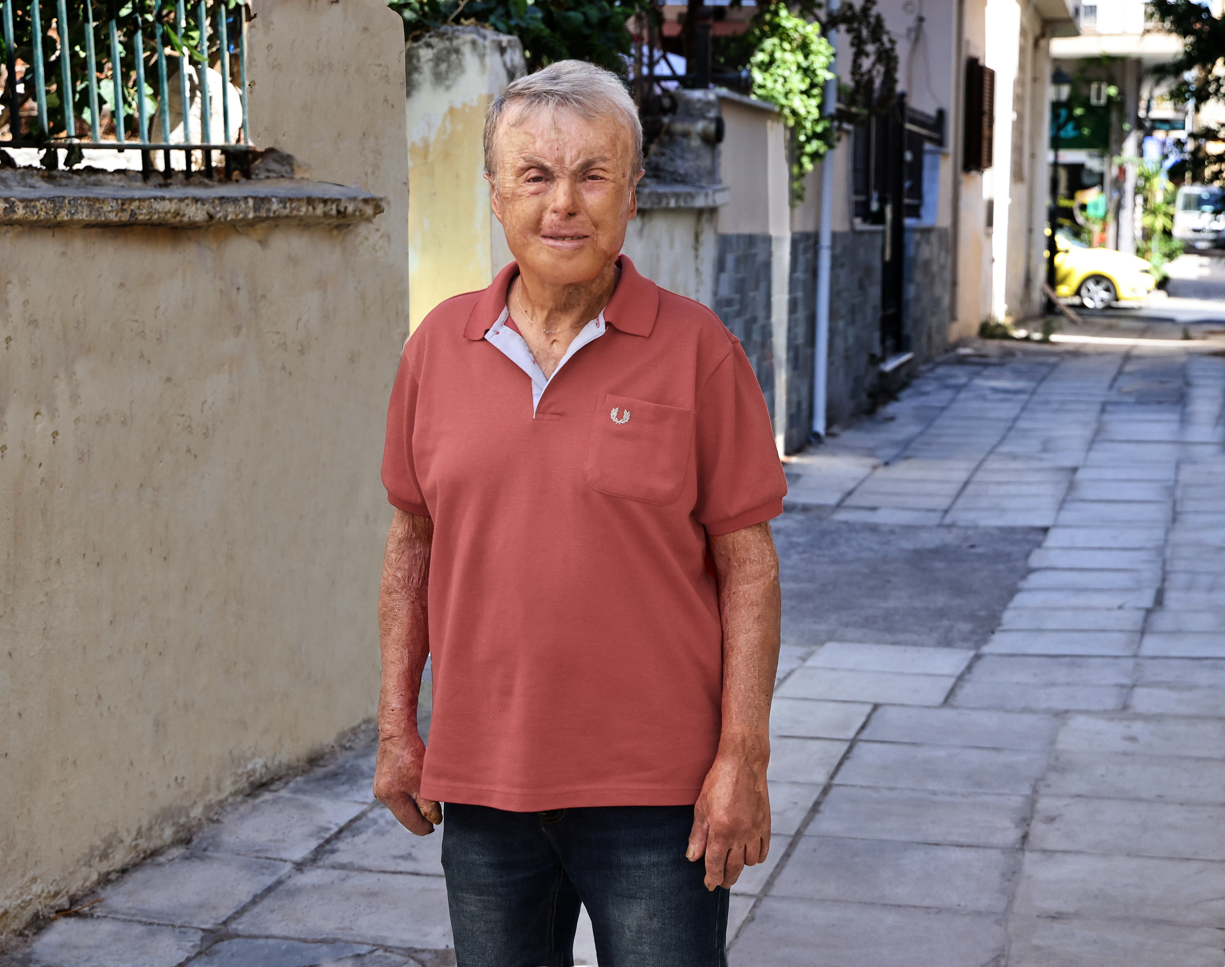 «Μετά τη φωτιά παλεύεις με τους δαίμονές σου»-6