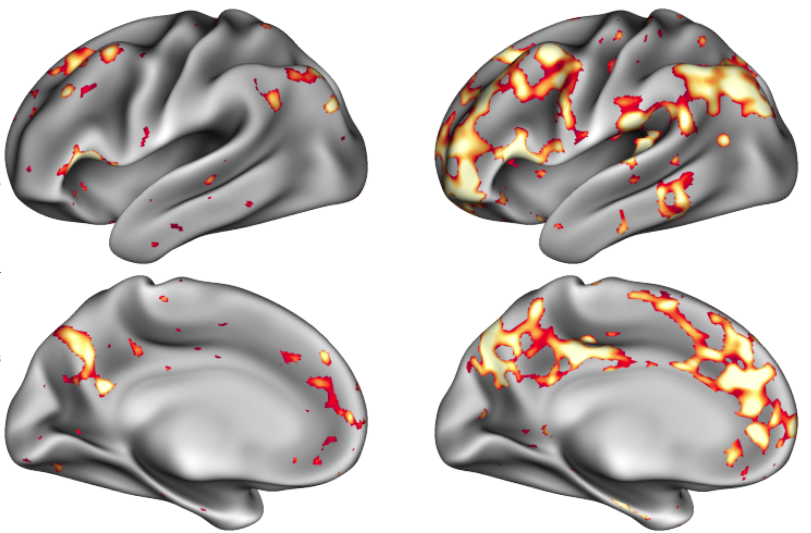 Αλεξάνδρα Τουρούτογλου: Μελετώντας τα μυαλά που δεν γερνούν-2