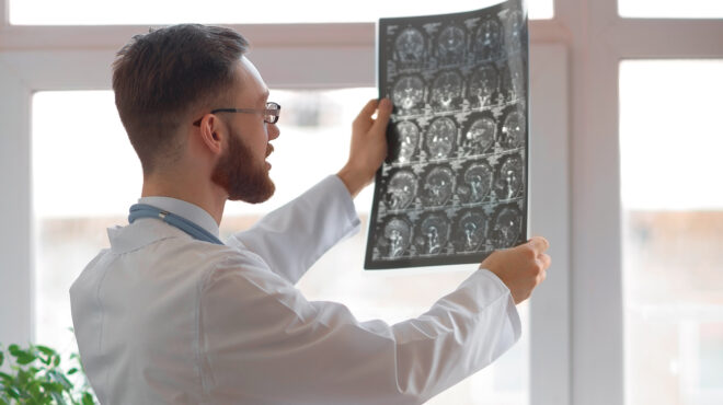 σύντομα-εγκεφαλικά-επεισόδια-βραχέα-563854501