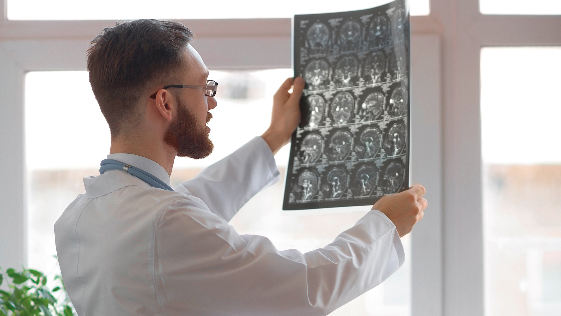 σύντομα-εγκεφαλικά-επεισόδια-βραχέα-563854501