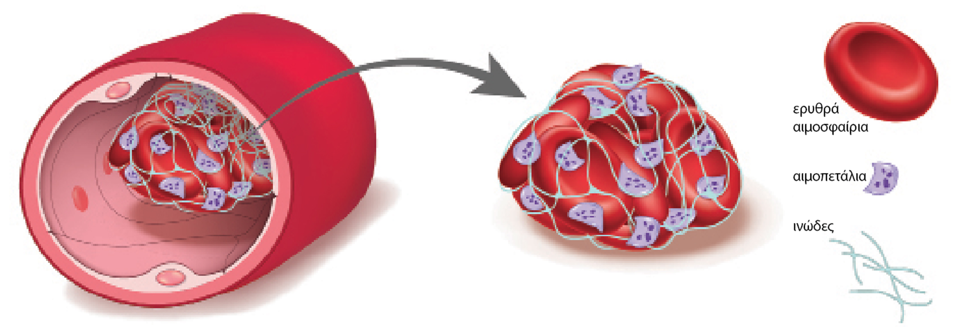 Τι νεότερο υπάρχει στην πρόληψη της θρόμβωσης-3