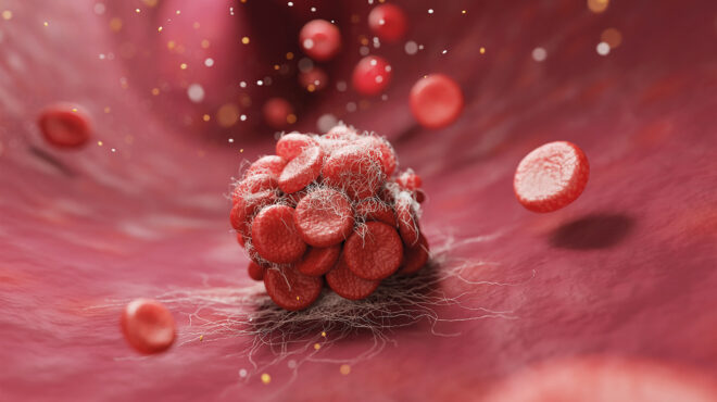 τι-νεότερο-υπάρχει-στην-πρόληψη-της-θρ-563854528