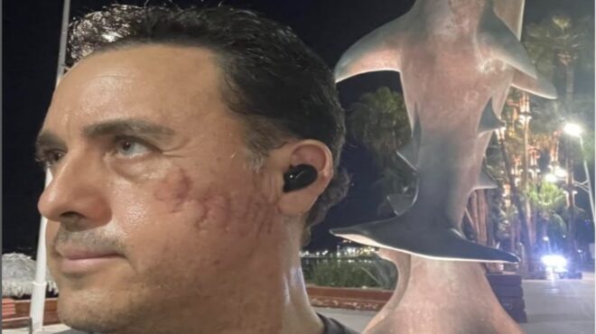 θέλει-να-συναντηθεί-ξανά-με-τον-καρχαρ-563914930