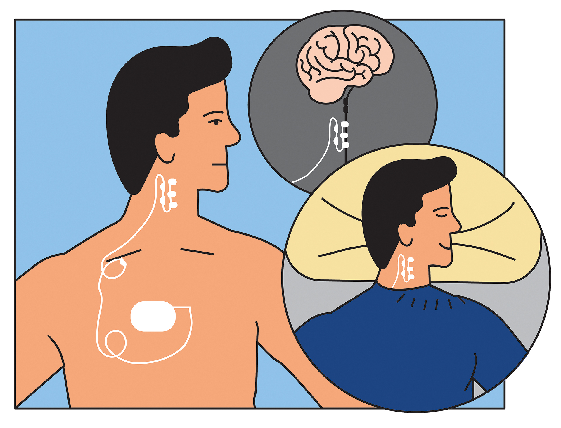 Το «άγνωστο» νεύρο που υπόσχεται να διώξει το στρες-2