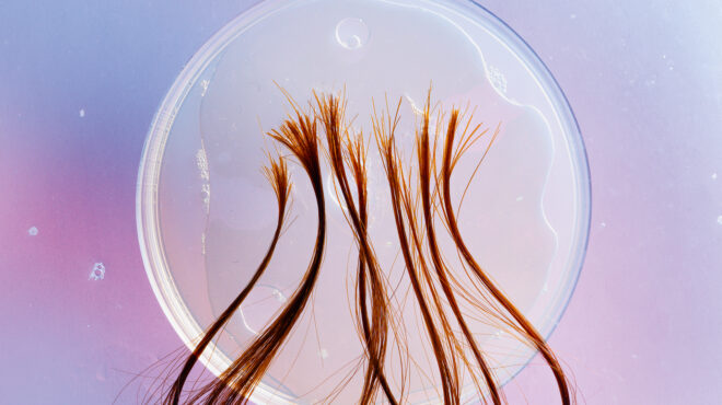 τι-λένε-τα-μαλλιά-μας-για-την-υγεία-μας-563940499