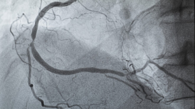 η-μεταβαλλόμενη-φύση-της-στεφανιαίας-563917039