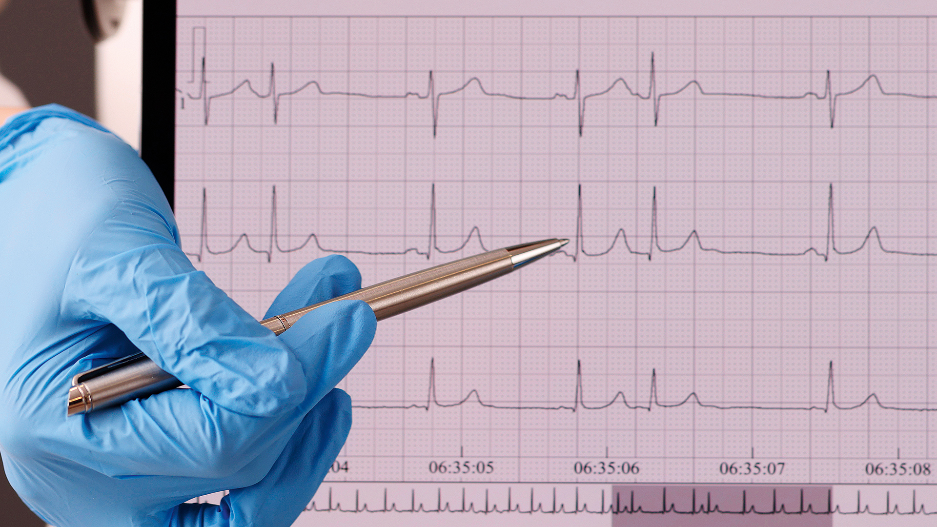 πότε-θα-πρέπει-να-ανησυχήσετε-για-μη-φυ-563929720