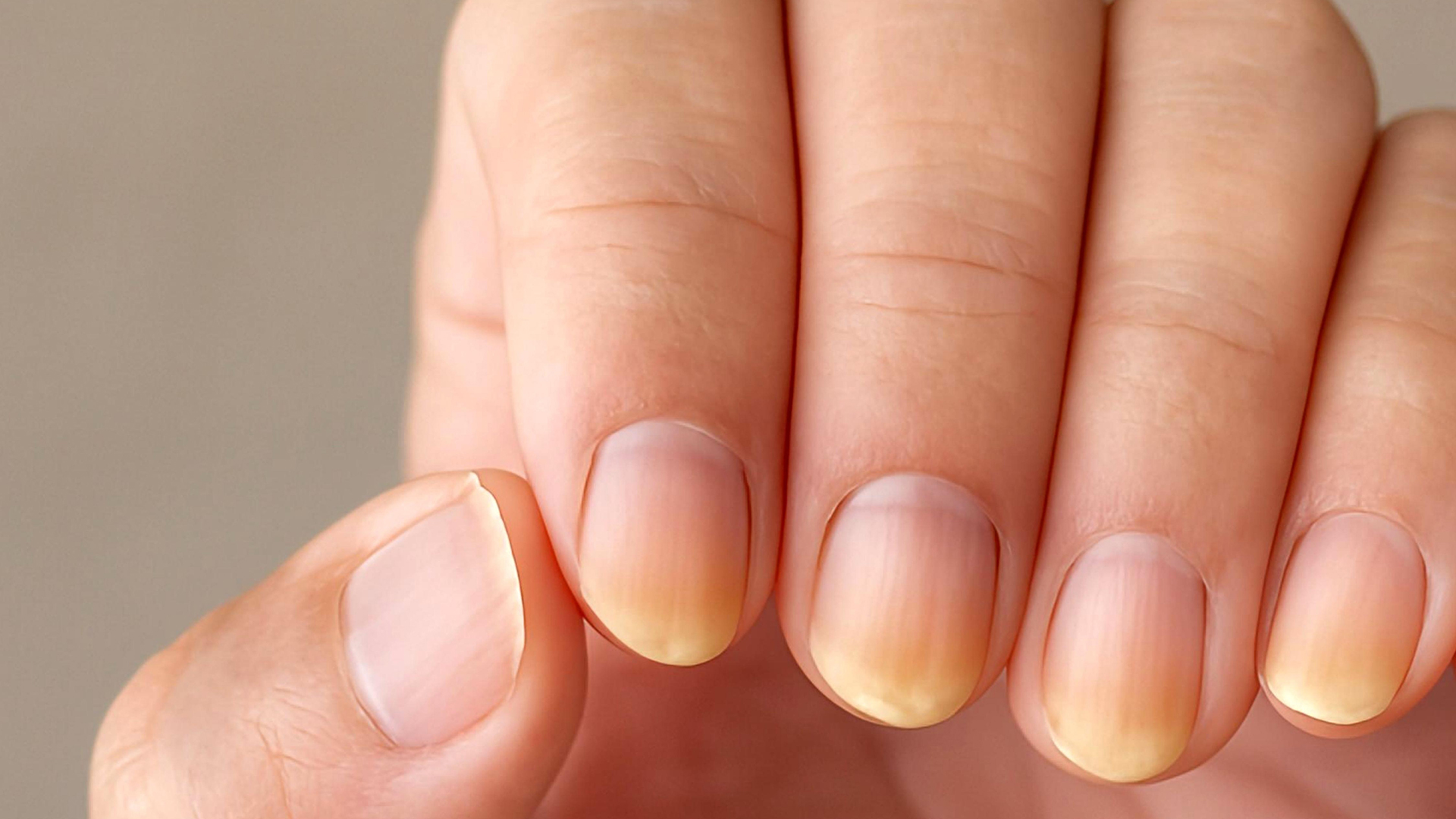 Μια ματιά στα προβλήματα των νυχιών-2