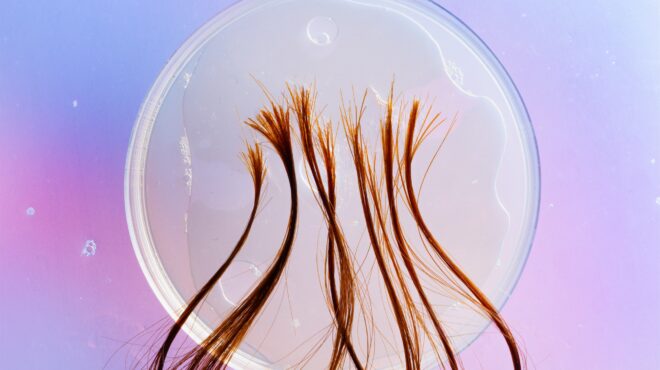 πώς-οι-τρίχες-μιλούν-για-την-υγεία-μα-563905432