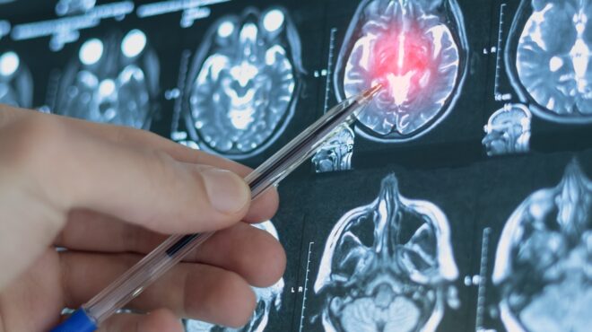 ερευνα-η-εφηβεία-διαρκεί-μέχρι-τα-30-563940292