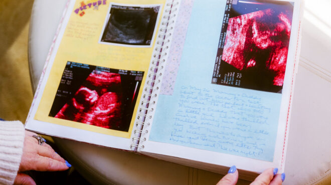 το-σιωπηλό-αποτύπωμα-των-επιπλοκών-563970067