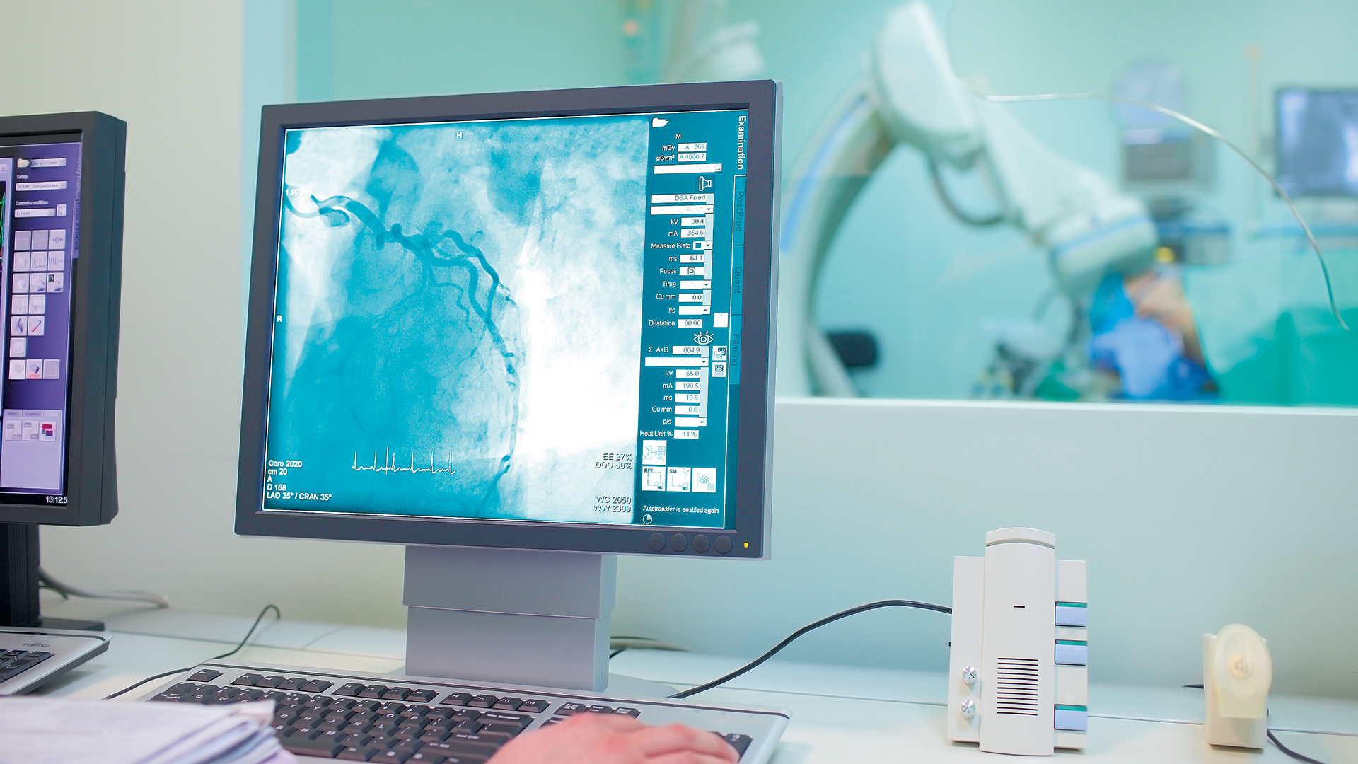 oταν-τυχαία-ευρήματα-τομογραφιών-αποκ-563953393