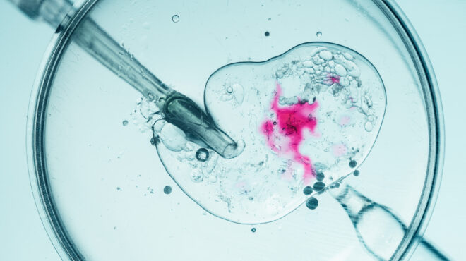 σε-7-κλινικές-στην-ελλάδα-το-σπέρμα-του-563968540