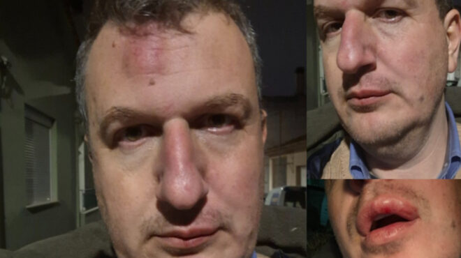 βόλος-ξυλοκόπησαν-τον-εκδότη-της-εφημ-564038797