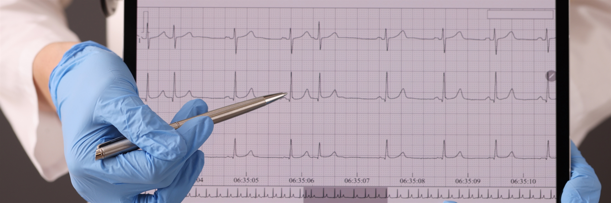 Τι πρέπει να γνωρίζετε για το αίσθημα παλμών της καρδιάς-2