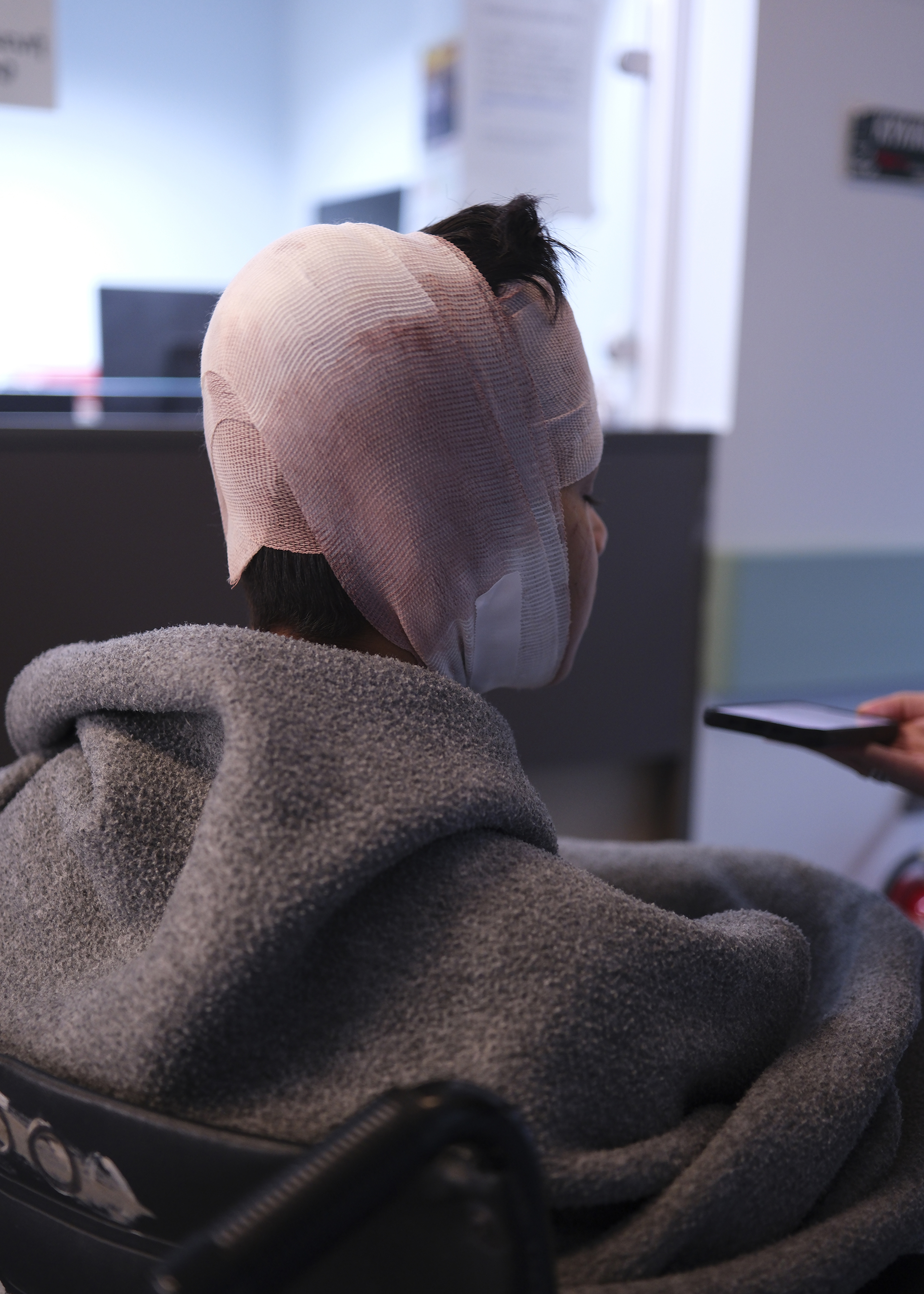 Χίος: «Τραγικές εικόνες – Σαν να ήσουν σε εμπόλεμη ζώνη»-1