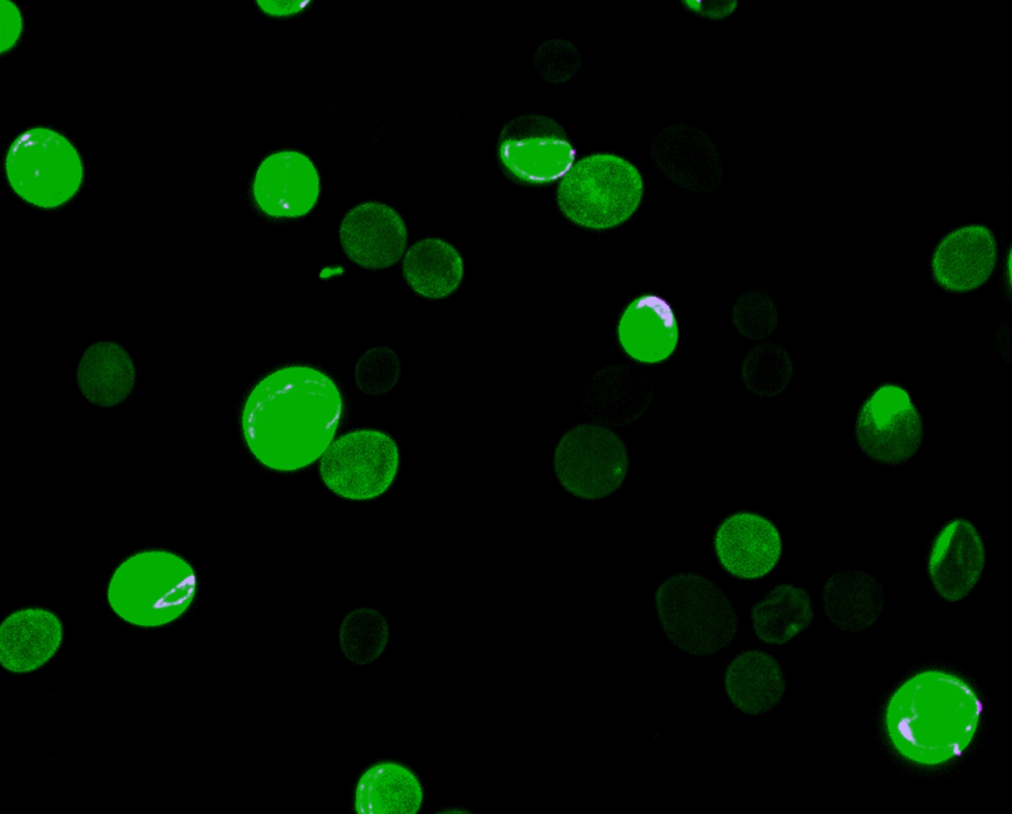 Ανάπτυξη «όπλου» κατά φονικού μύκητα-2