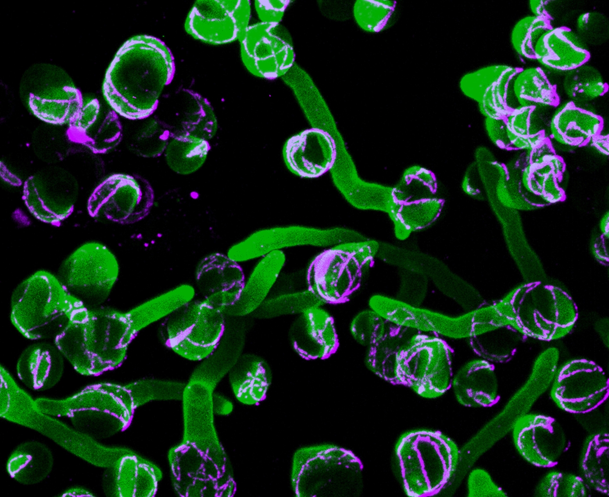 Ανάπτυξη «όπλου» κατά φονικού μύκητα-1