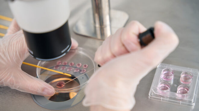 γαλλία-εμβρυο-με-σπάνιο-αγγειακό-όγκο-564080977