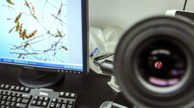 κρούσματα-σπάνιας-μηνιγγίτιδας-στο-κ-564129508