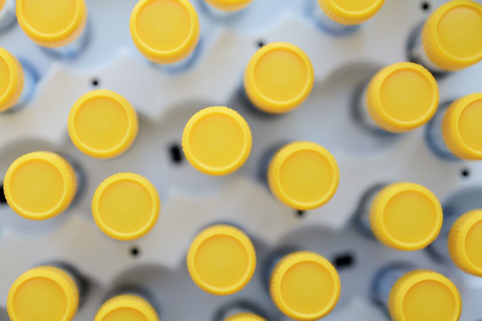 Διάγνωση: στρατηγικός πυλώνας για βιώσιμα συστήματα υγείας-2