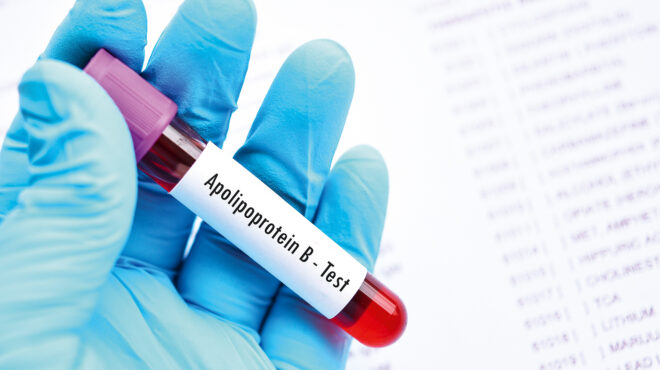 είναι-η-εξέταση-της-apob-καλύτερη-μέθοδος-564155041