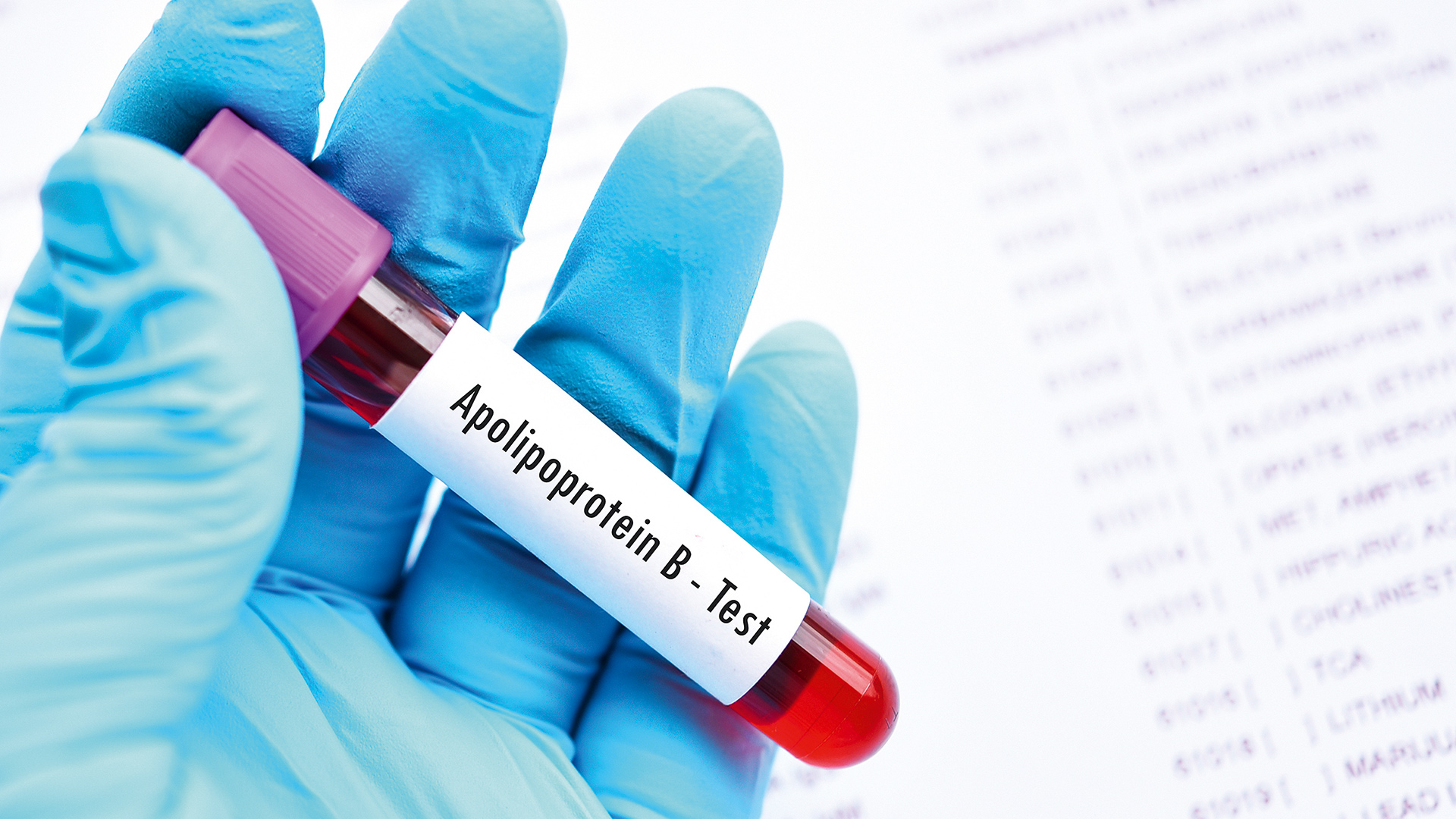 είναι-η-εξέταση-της-apob-καλύτερη-μέθοδος-564155041