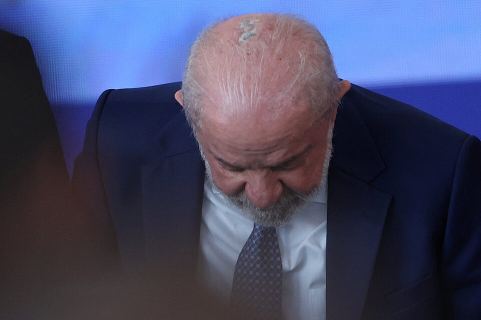 Βραζιλία: Ο Λούλα διαγνώστηκε με καρκίνο του δέρματος-1