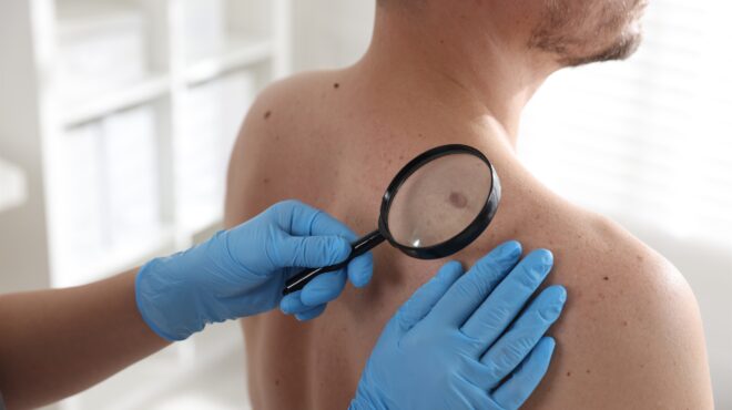 σπύρος-γιαμάς-στην-κ-κάνουμε-τον-hpv-α-564249700