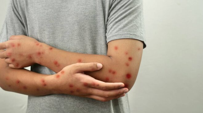 ηπα-ρεκόρ-35ετίας-σημείωσαν-τα-κρούσματ-564370732